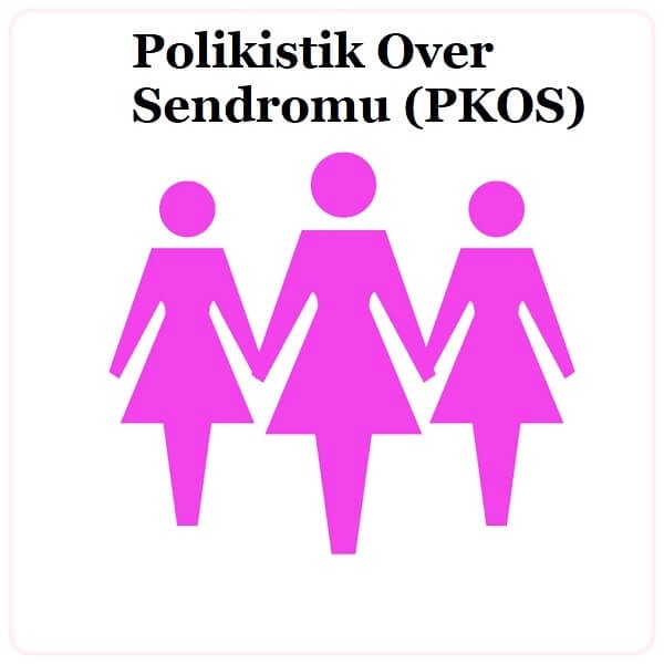 PCOS’UM KİLO VERME İLE TEDAVİ EDİLEBİLİR Mİ?